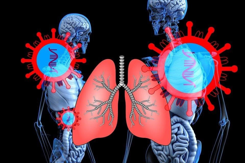 Tips for Treating Chronic Bronchitis at Home